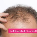 Saç Dökülmesine İyi Gelen Çiçekler